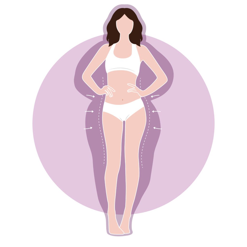 Liposuccion du ventre : Prix, facteurs et conseils 2 Liposuccion illustration