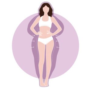 Liposuccion illustration